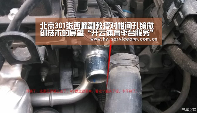 北京301张西峰副教授对椎间孔镜微创技术的展望“开云体育平台服务”(图1) 开云体育官方